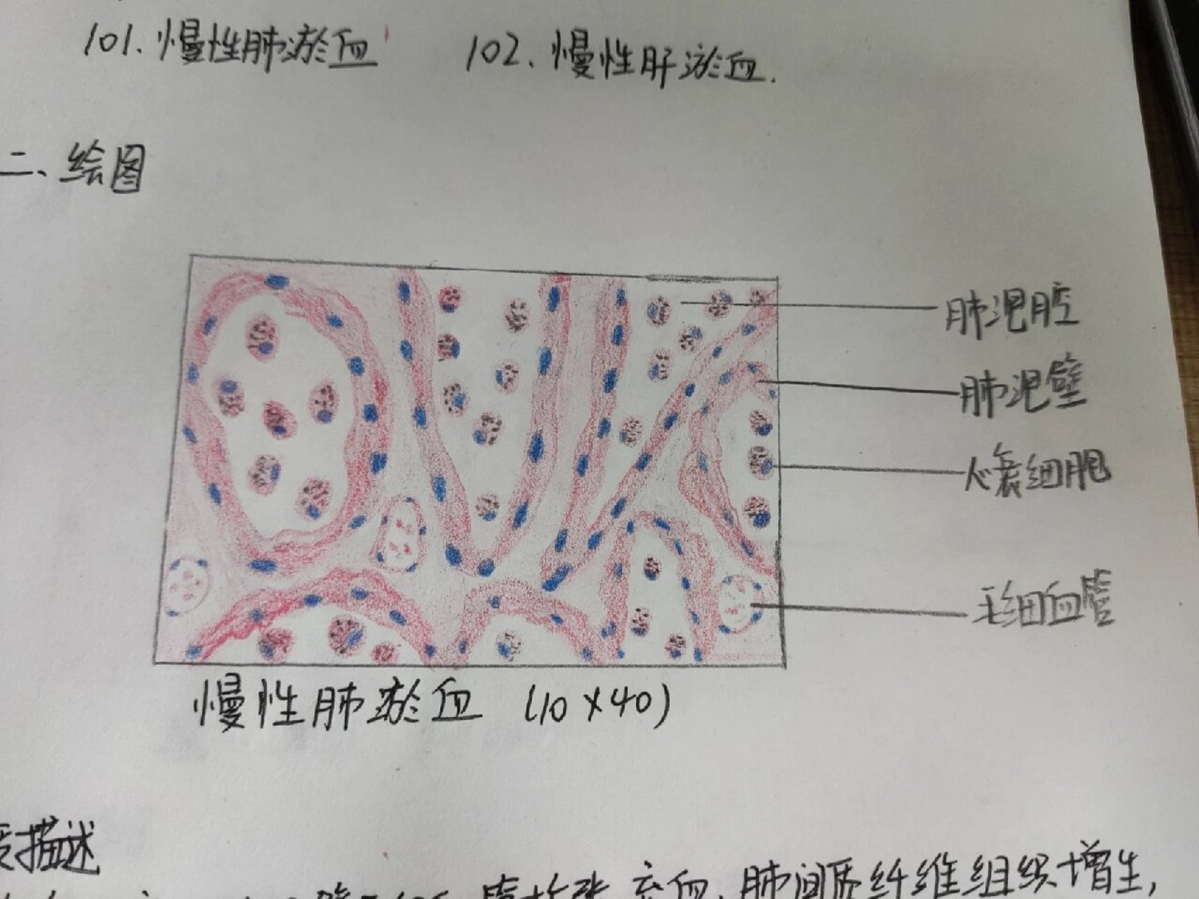 肺淤血绘图图片