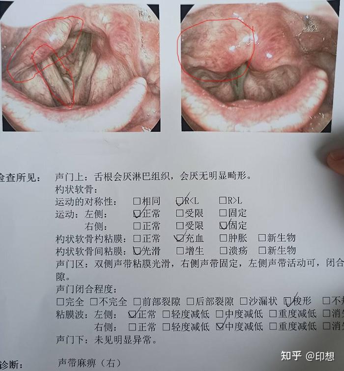 犬声带切除术教程图片