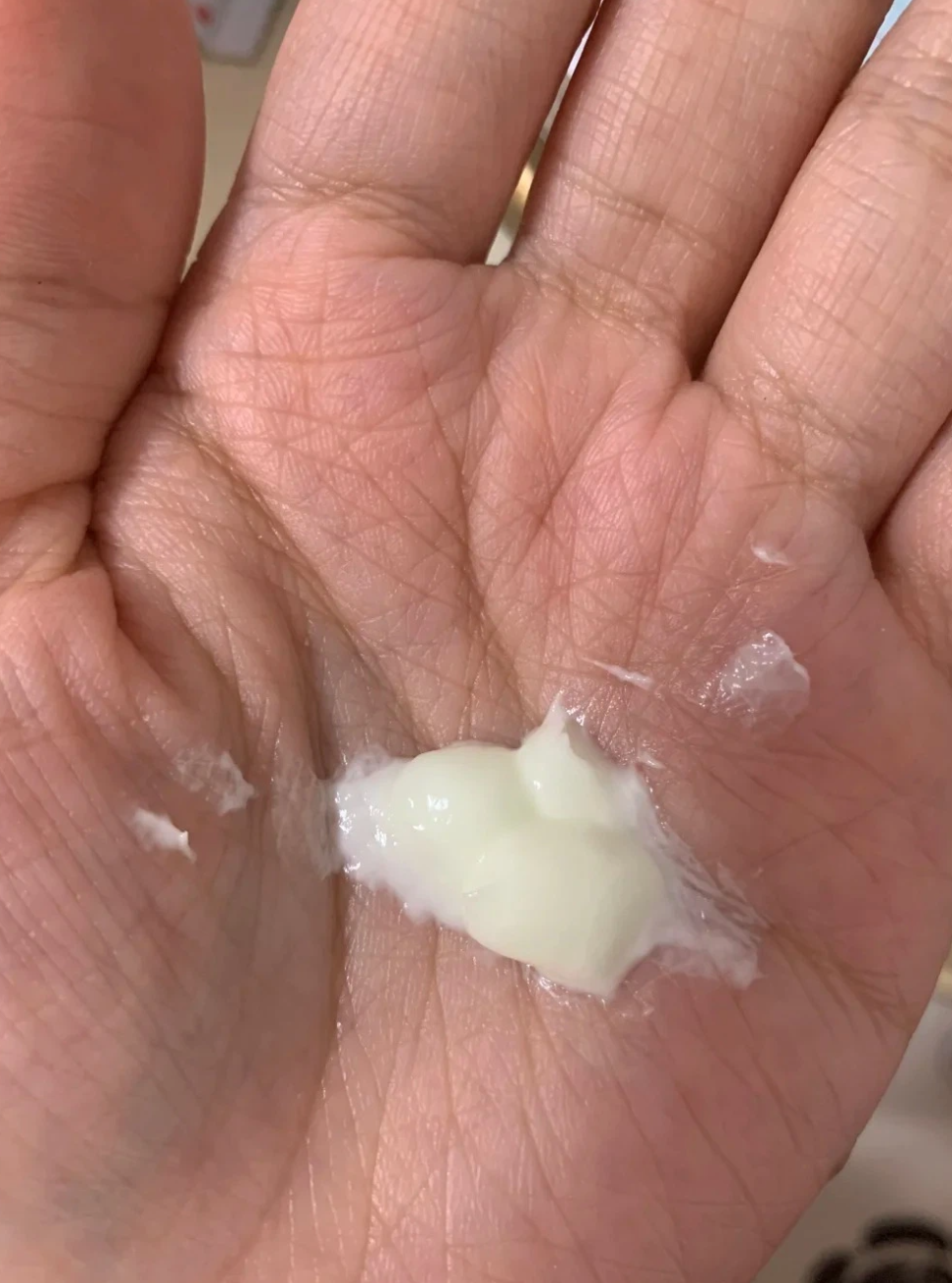 长期熬夜不会直接改变脸型,但会影响面部皮肤状态