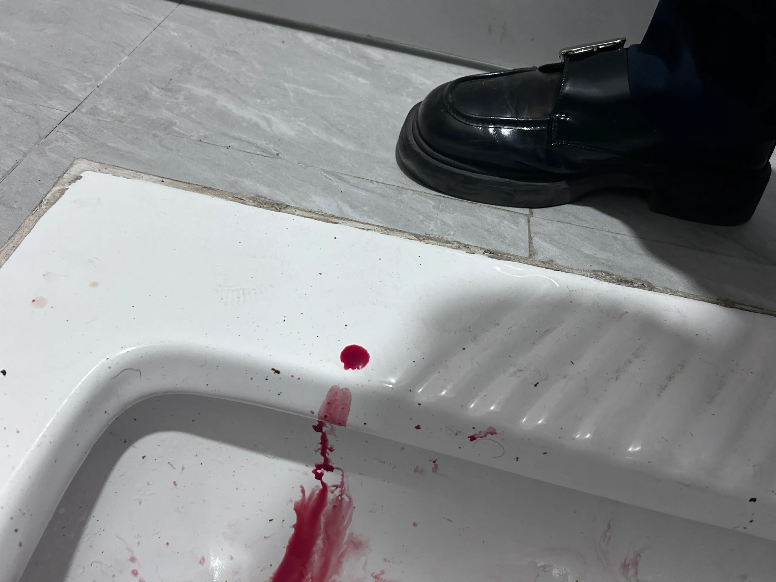 痔疮出血
