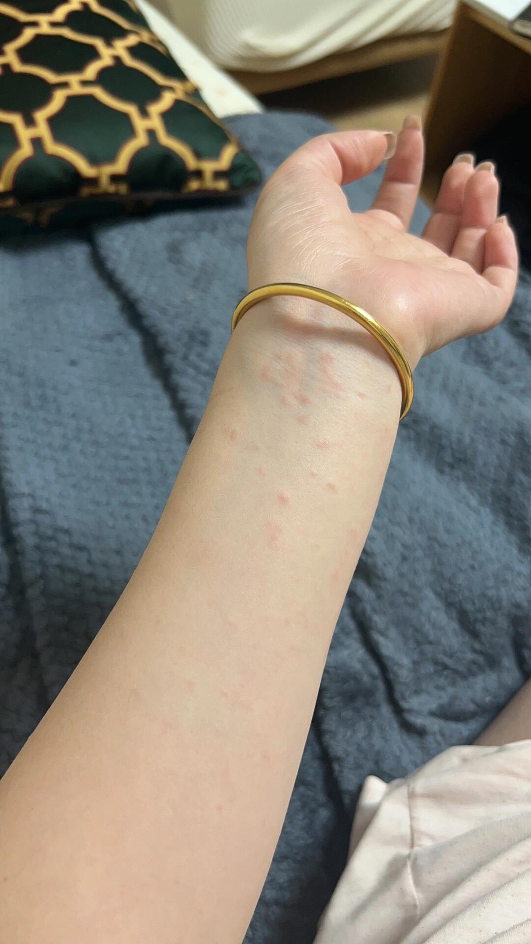 我说我甲醛过敏,你信吗[流泪]