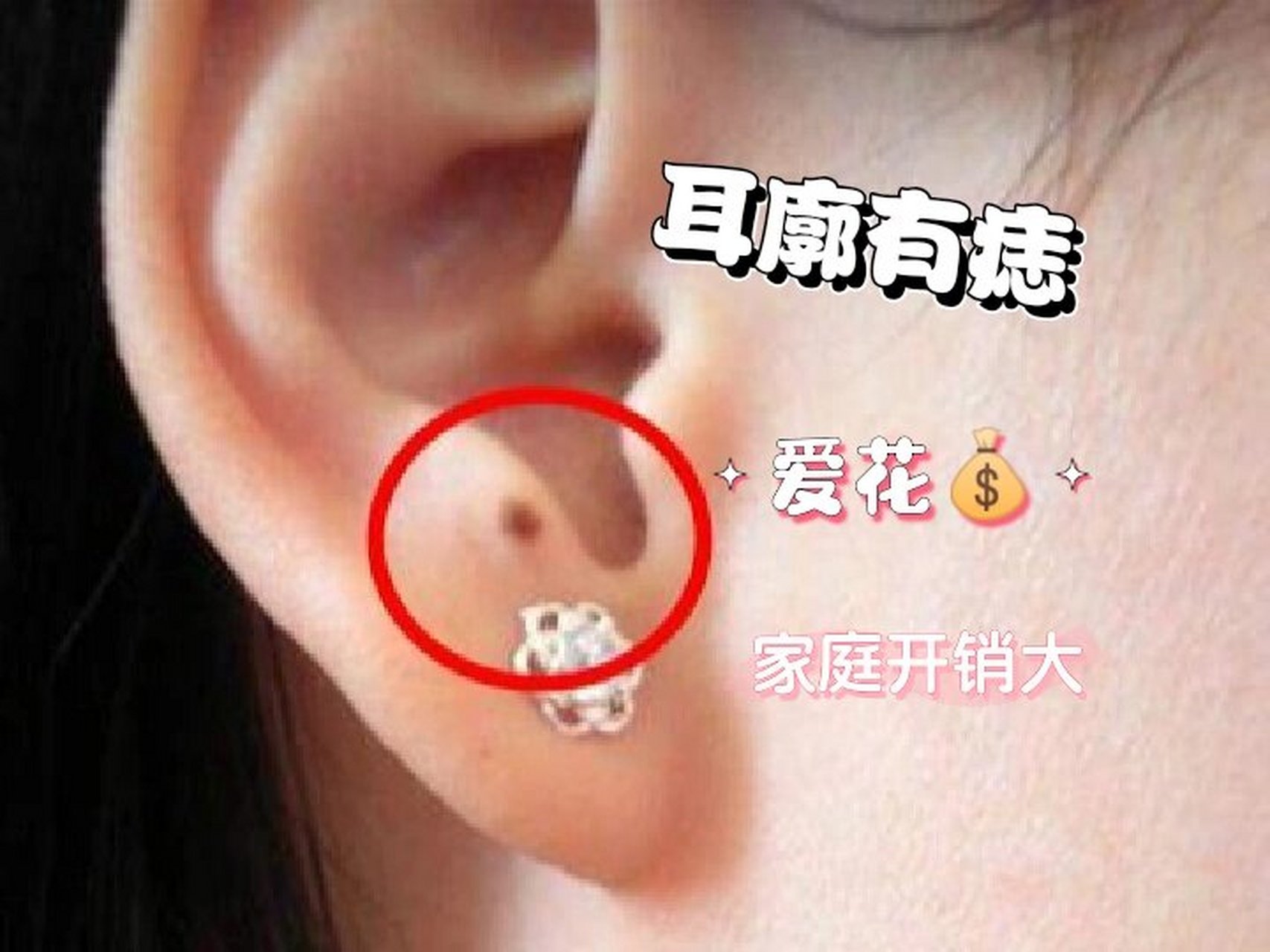 耳廓有痣的女人爱花💰,耳廓就是耳朵边缘部分,这里有痣的女性很