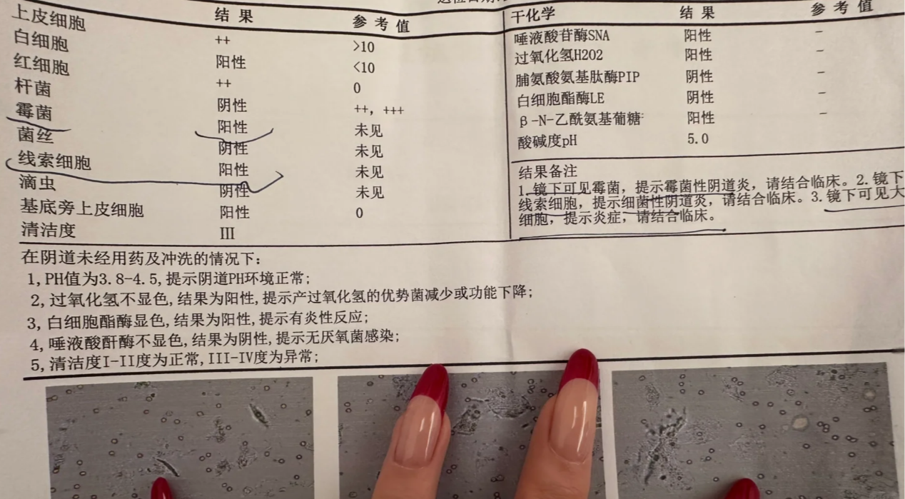 为什么白带过多