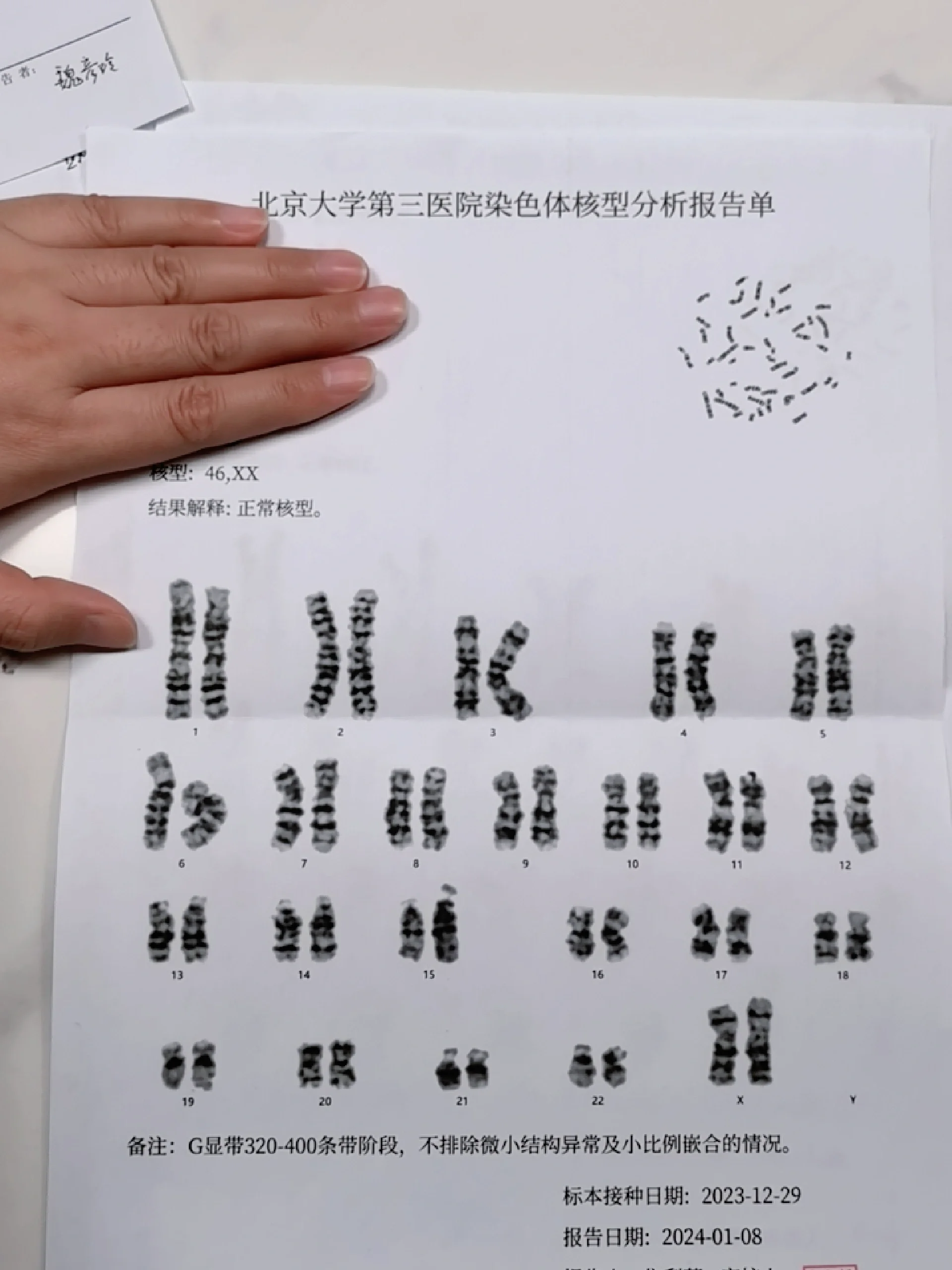 我觉得我除了46xx也不能是别的了呀[汗颜r] 北医三院的核型分析,这能