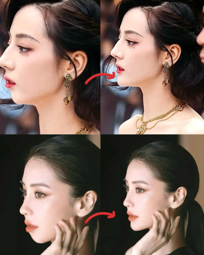 有多少姐妹还在为下巴后缩和嘴凸烦恼啊,正脸显方,侧脸显土!谁懂啊