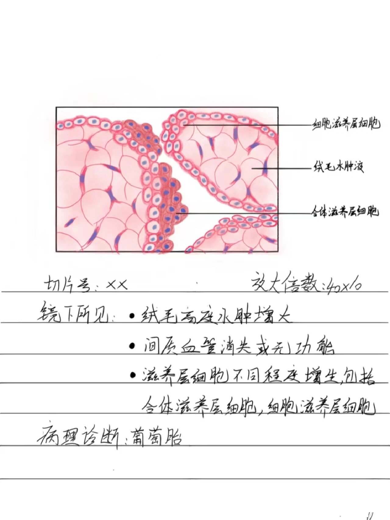 假小叶红蓝铅笔图图片