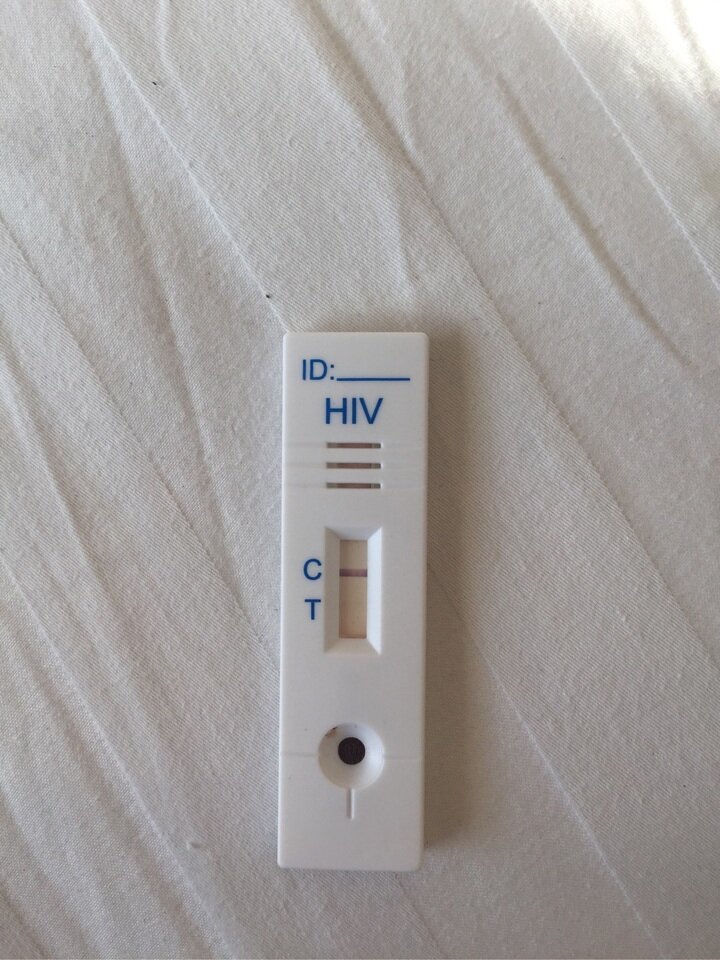 hiv试纸检测t线那条杠颜色很弱 hiv试纸产品的判读不是以t线是否显色