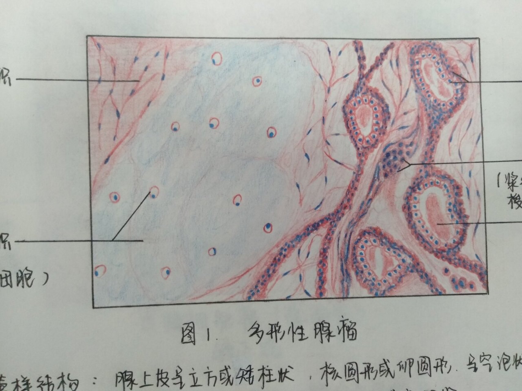 口组红蓝铅笔绘图② 96多形性腺瘤 96成釉细胞瘤(滤泡型) 96牙