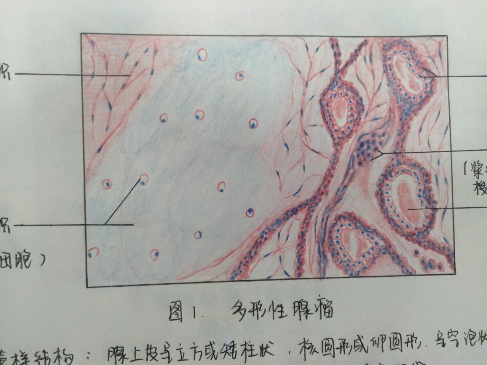 乳腺癌红蓝铅笔绘图图片