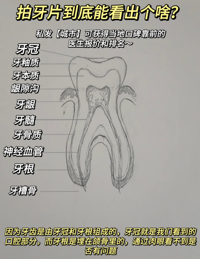 牙齿解剖图片大全 图图片