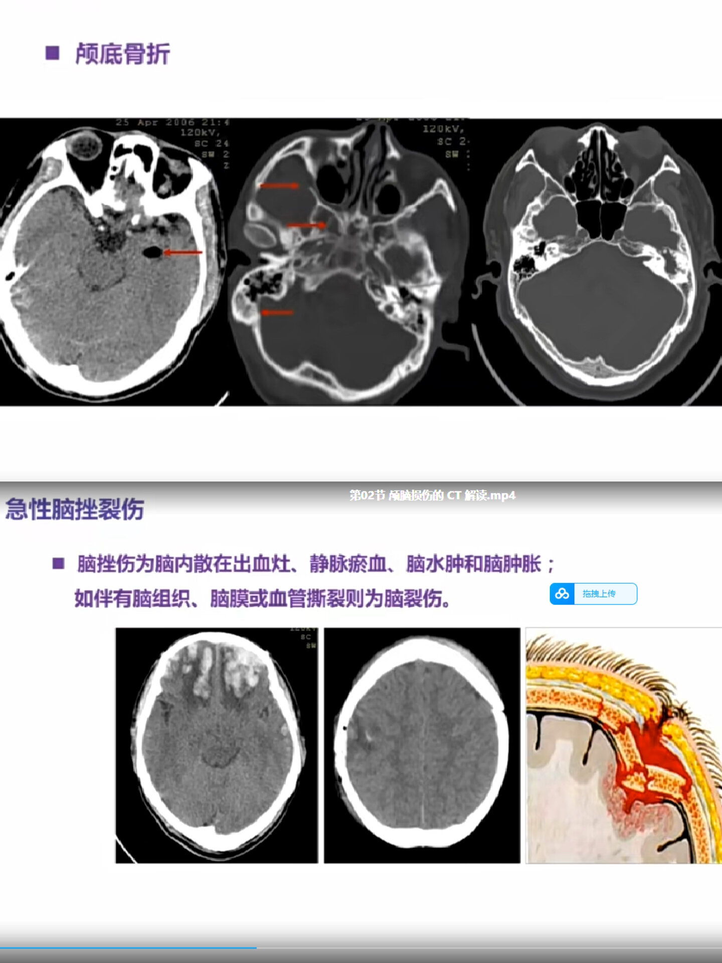 医学影像学片子图片