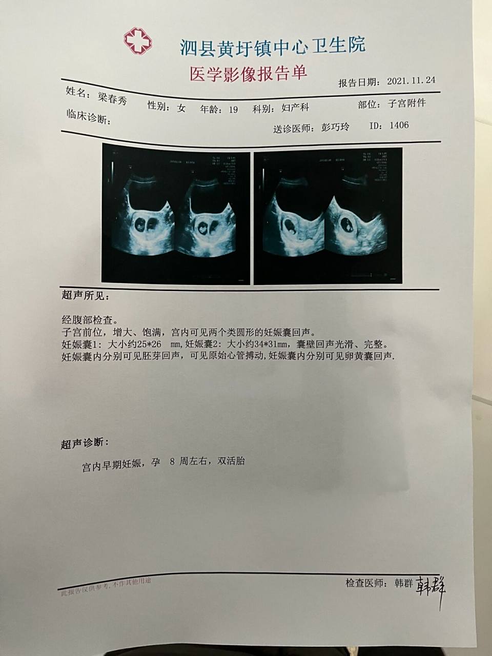 怀孕一个月左右的时候去做了彩超图,因为是输卵管通而不通自然受孕
