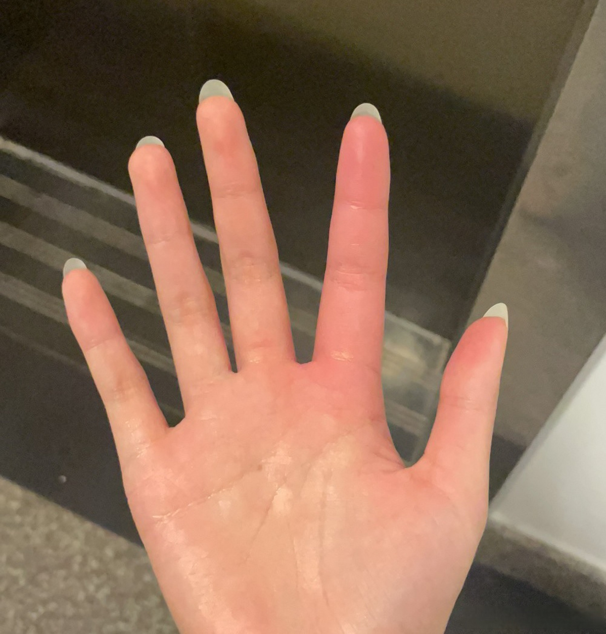 梦见蜂蜜咬我的手(梦见蜜蜂蛰我的手指感觉疼)