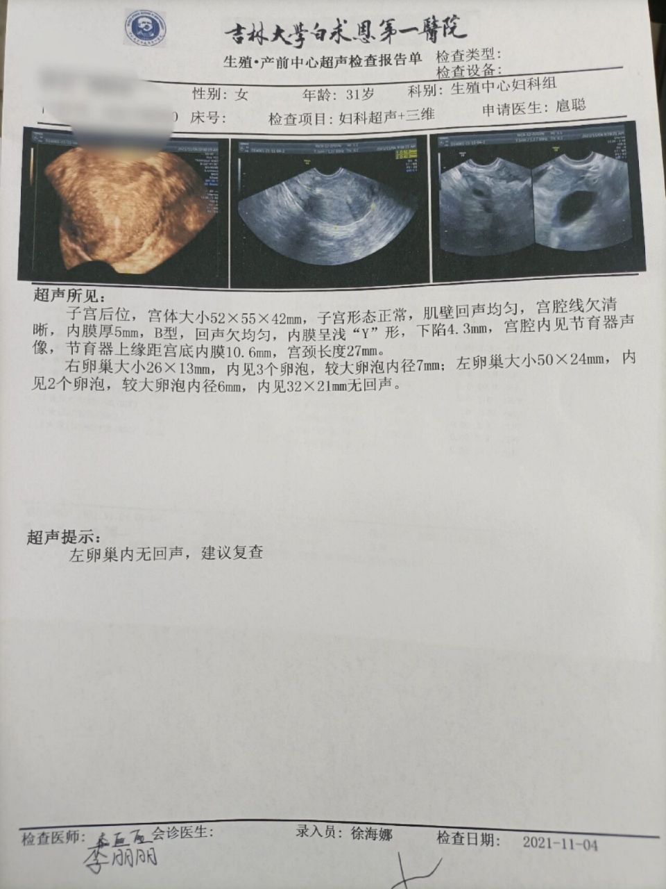 曼月乐戴半年了,下移了 4月18号戴曼月乐的,这才半年时间就下移了,还