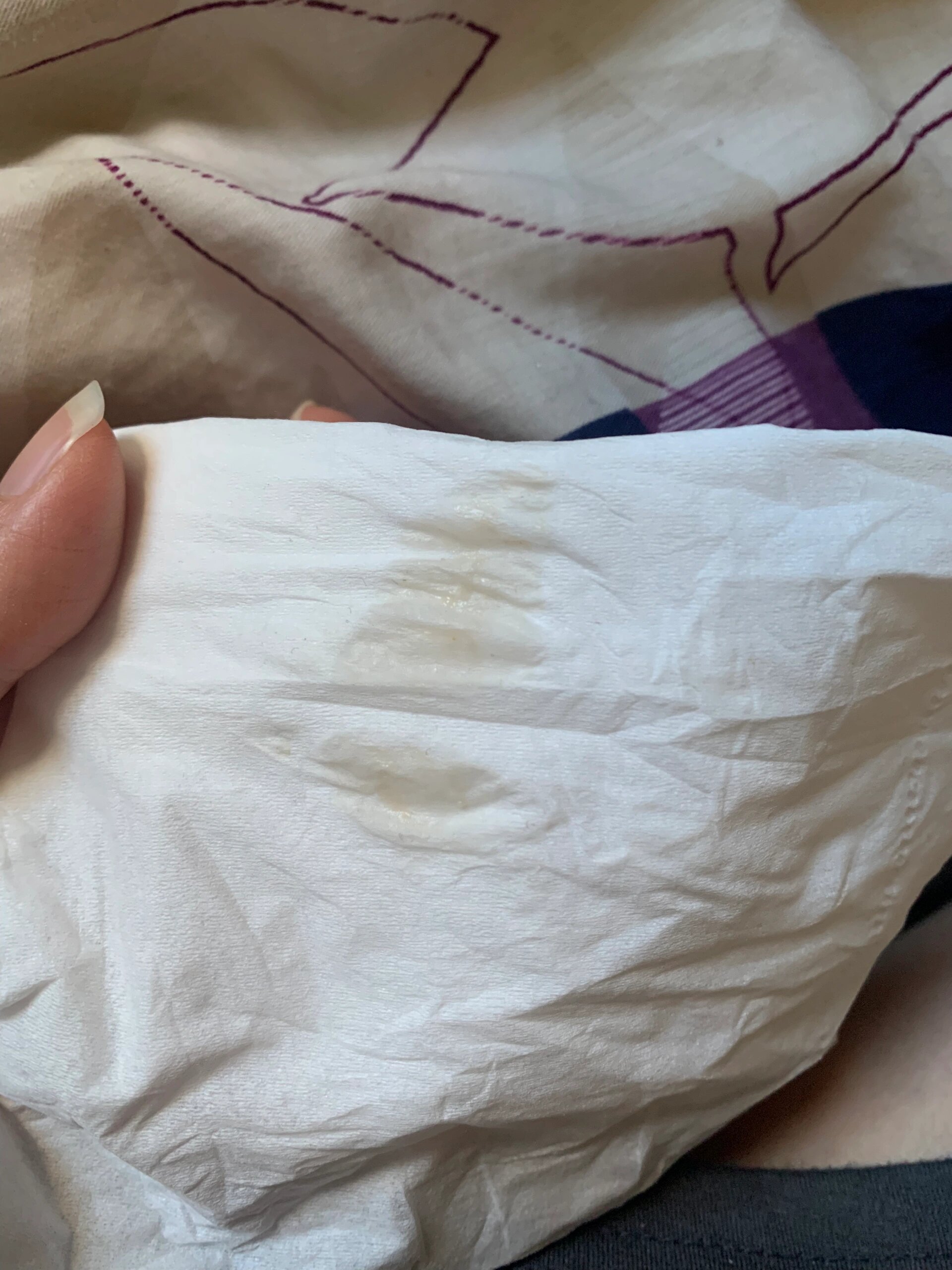 怀孕大约5-6周,有浅咖啡色分泌物是正常吗