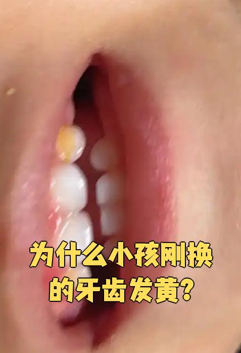 牙为什么黄