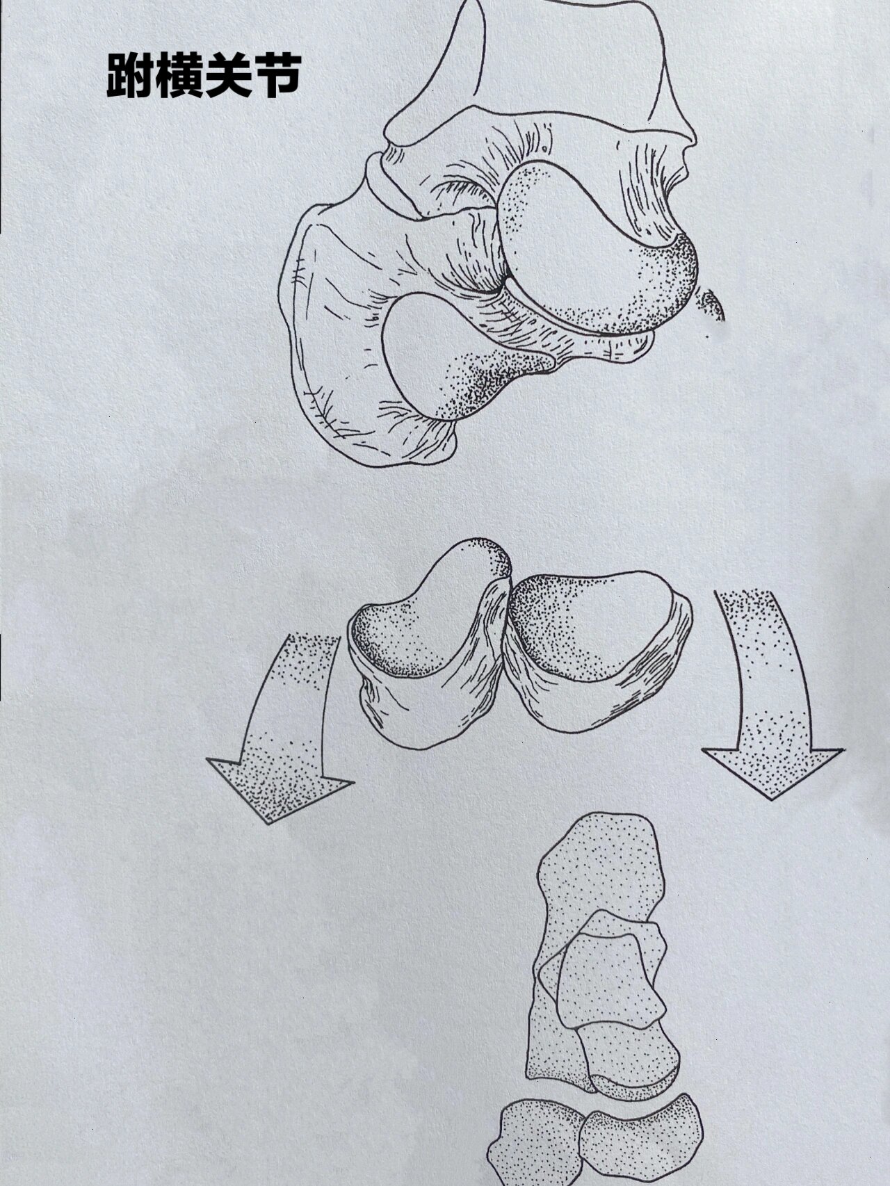 跗横关节图片