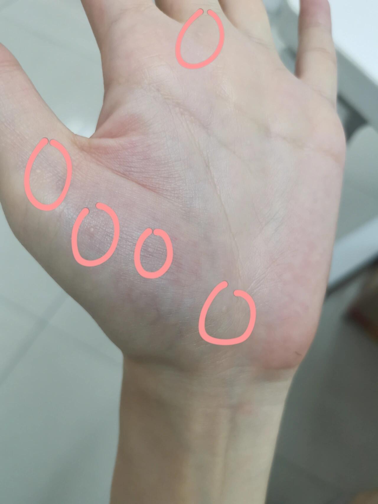 如图,有没有兄弟姐妹们知道这是什么?