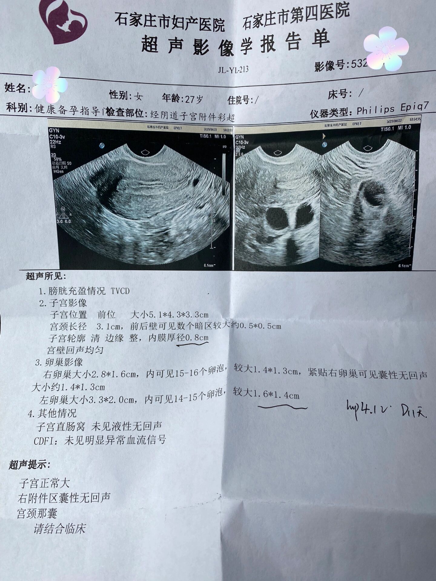 22去石家庄妇产医院做阴超检查卵泡大小,个数 1