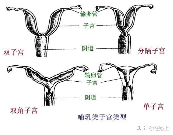 双角子宫可能怀双胎吗