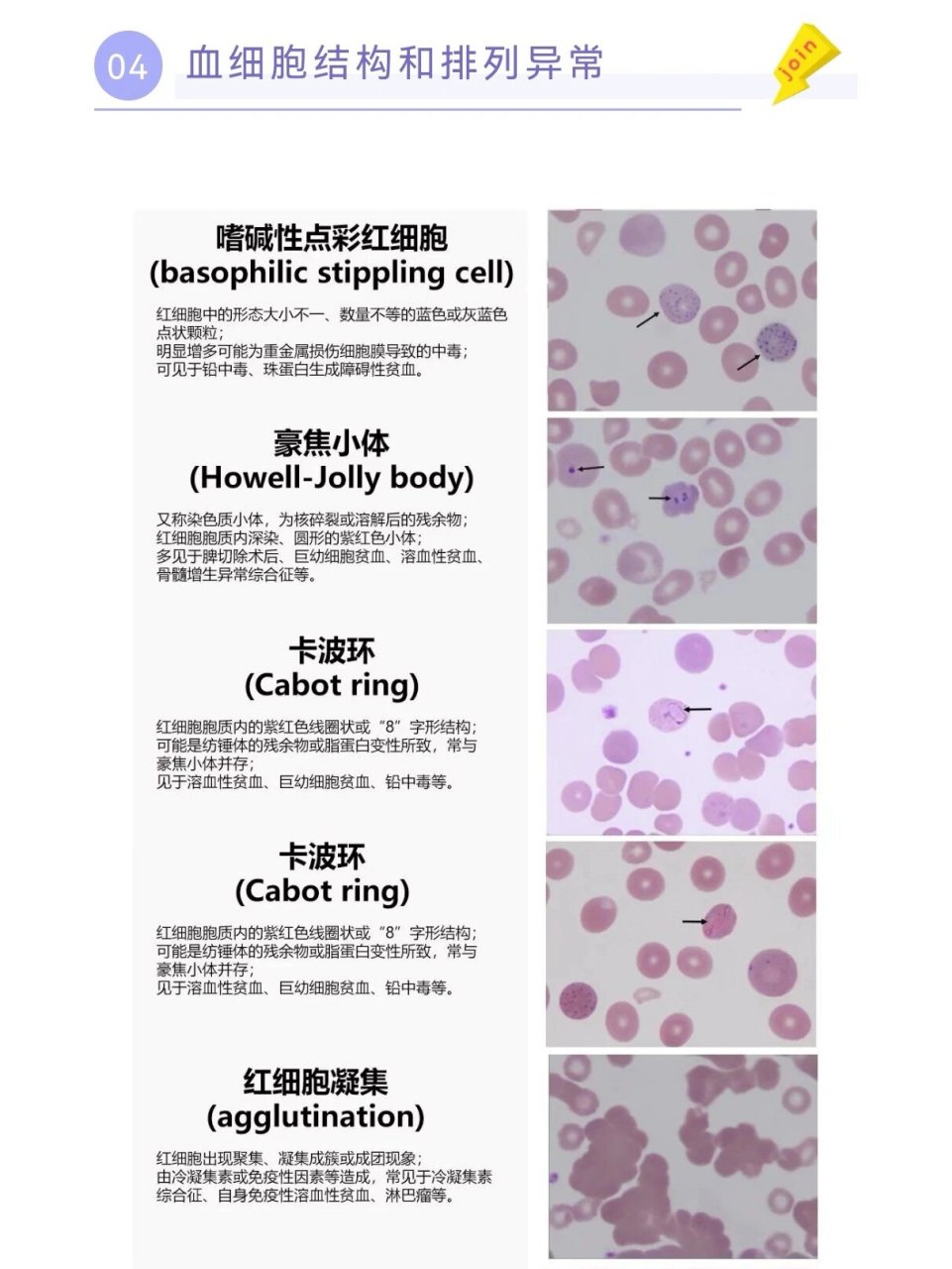 嗜碱性点彩红细胞图片