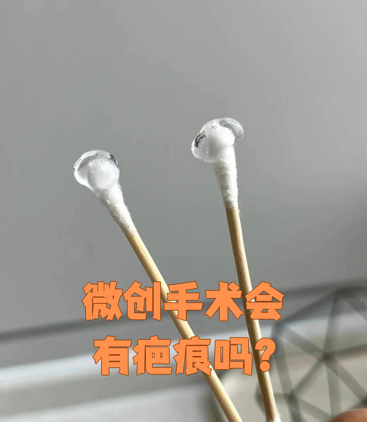 微创手术是在腹腔镜胸腔镜等器械帮助下完成的手术时对皮肤的损伤