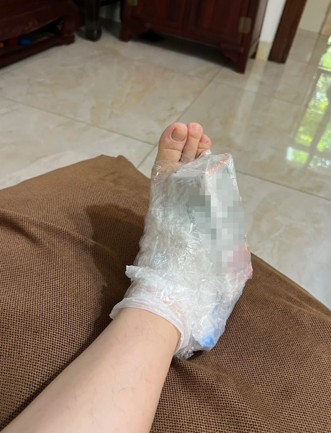 如果这一个月里经常活动脚踝或走路太多,肿胀就更难消退