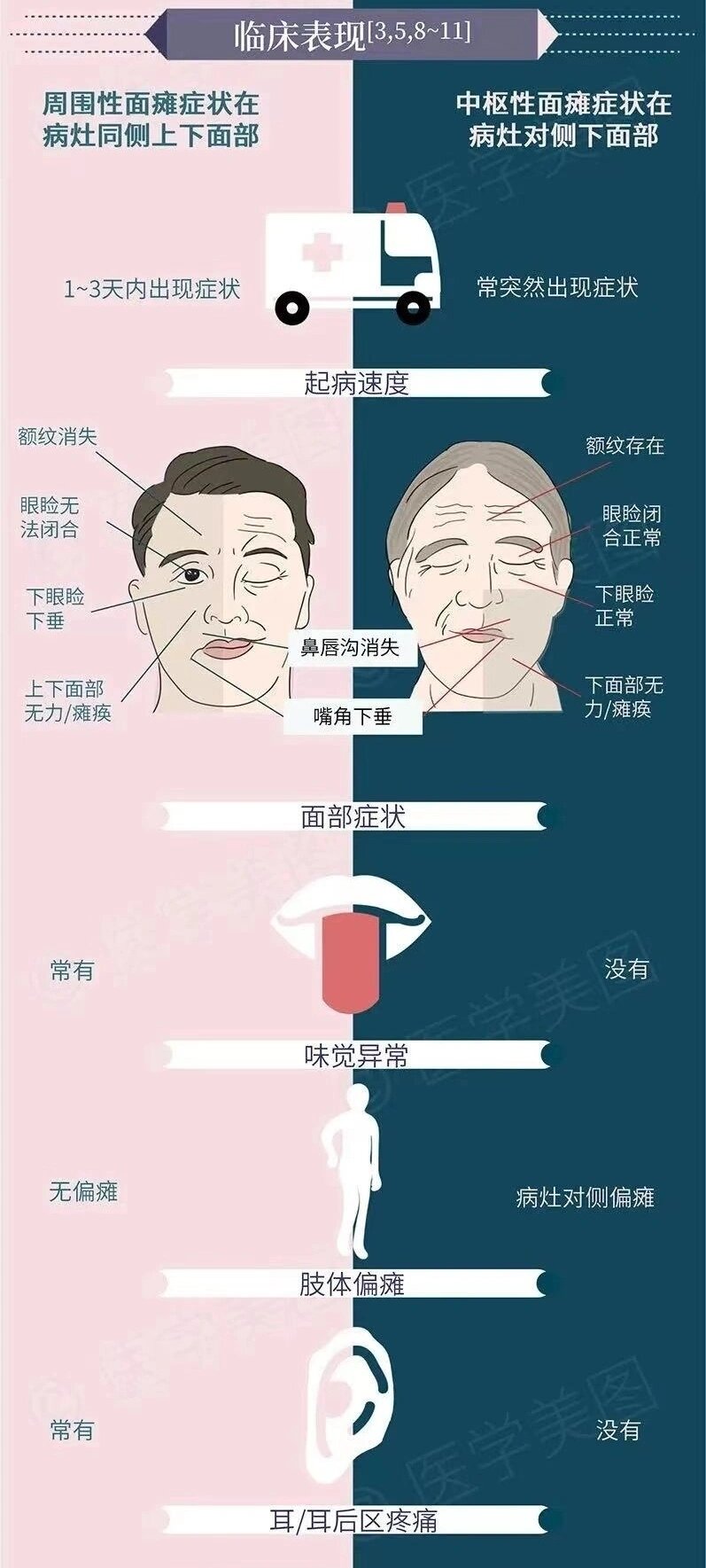 周围性面瘫与中枢性面瘫区别