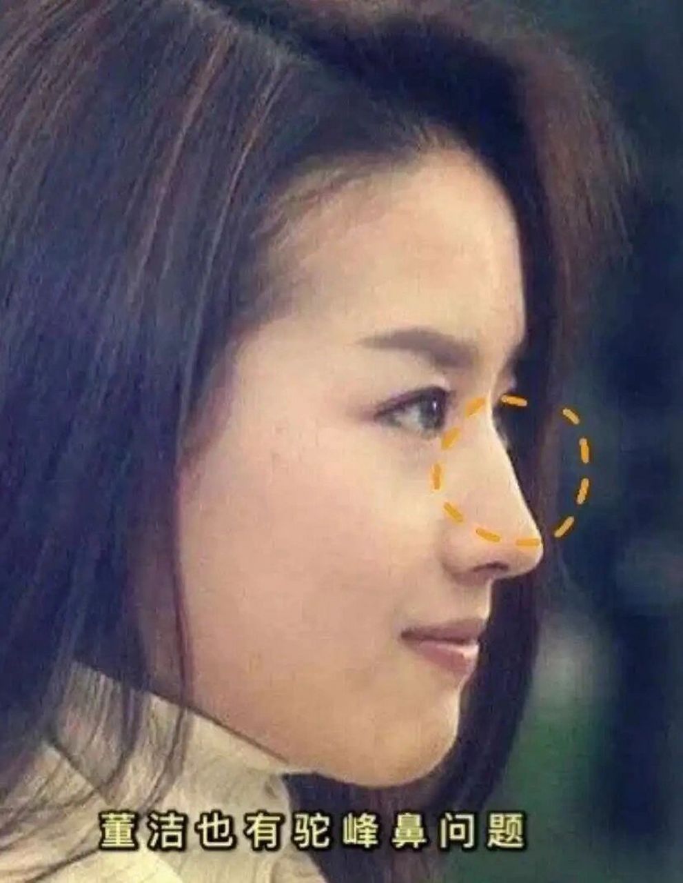 如果鼻子斜曲不直,就会有口舌是非缠身 如果鼻梁中间部位起节 女人还