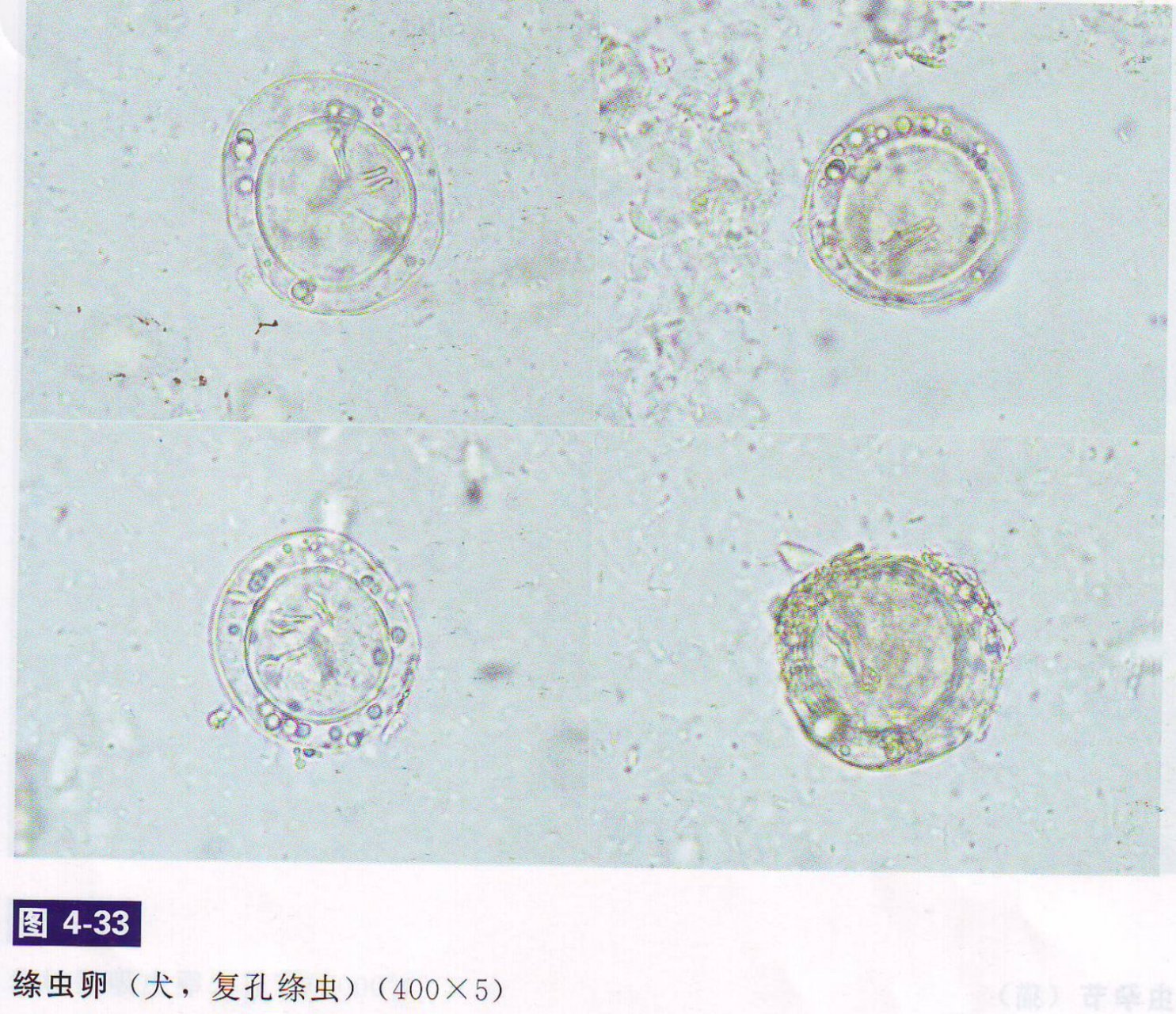 粪便常规镜检图片图片