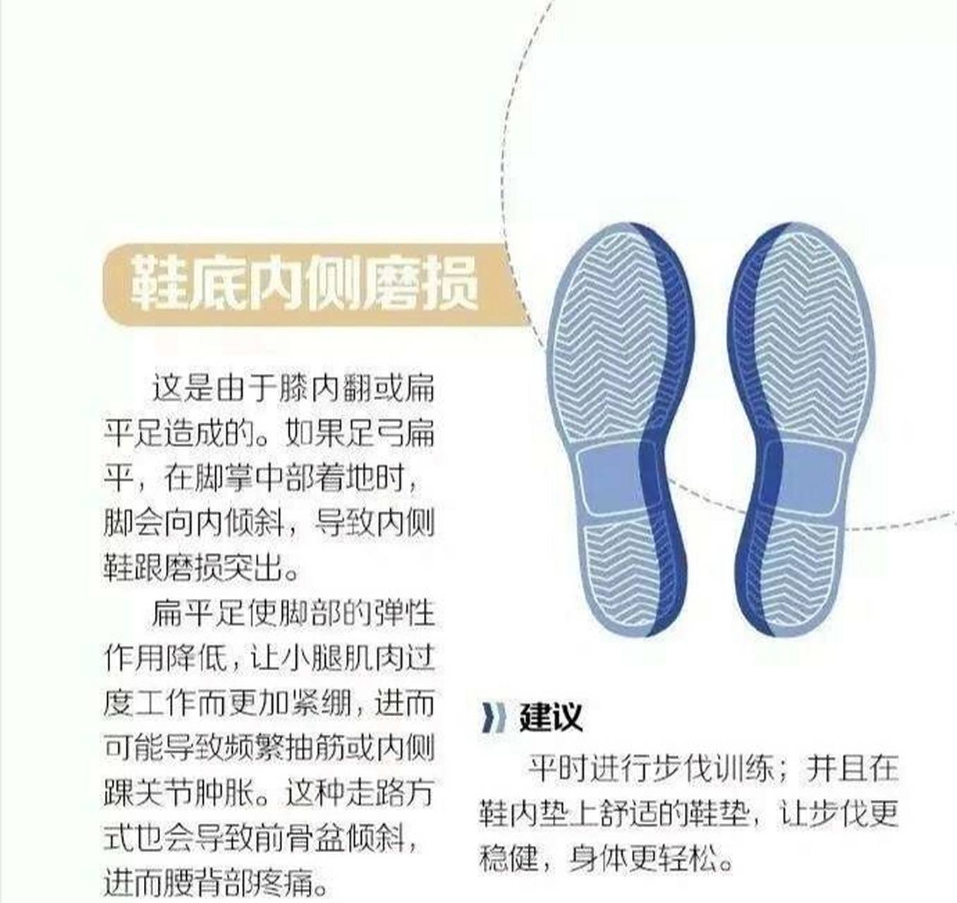 你的鞋底磨损严重吗 1,外侧都出现磨损 有些人走路是比较明显的外八字