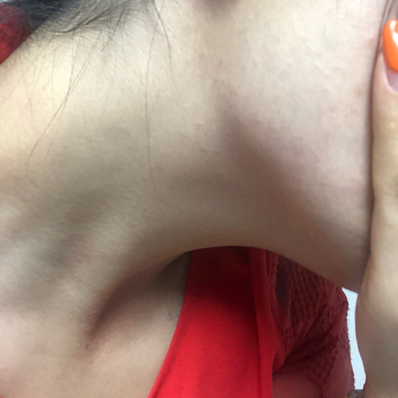 中央2财经频道女主持人脖子下面全是疙瘩的简单介绍