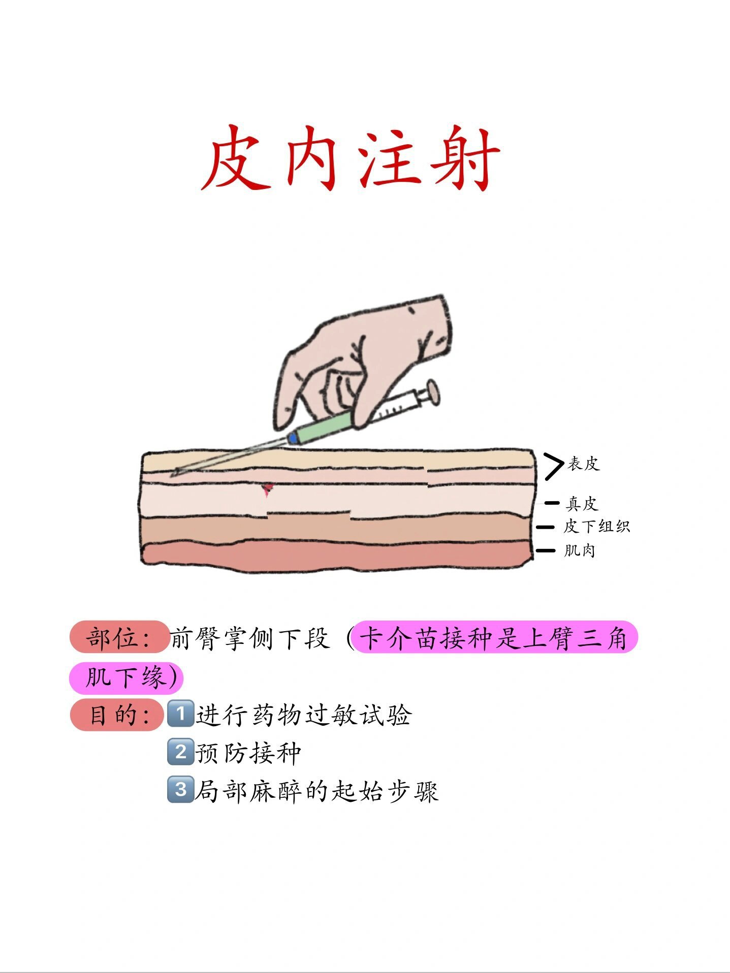 im肌肉注射图片