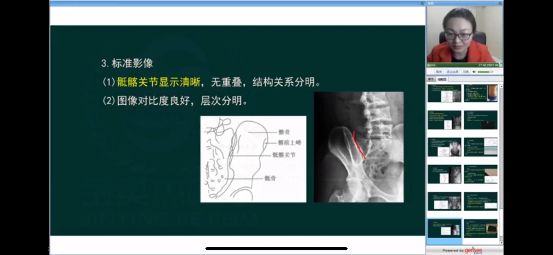 骶髂关节x片图片