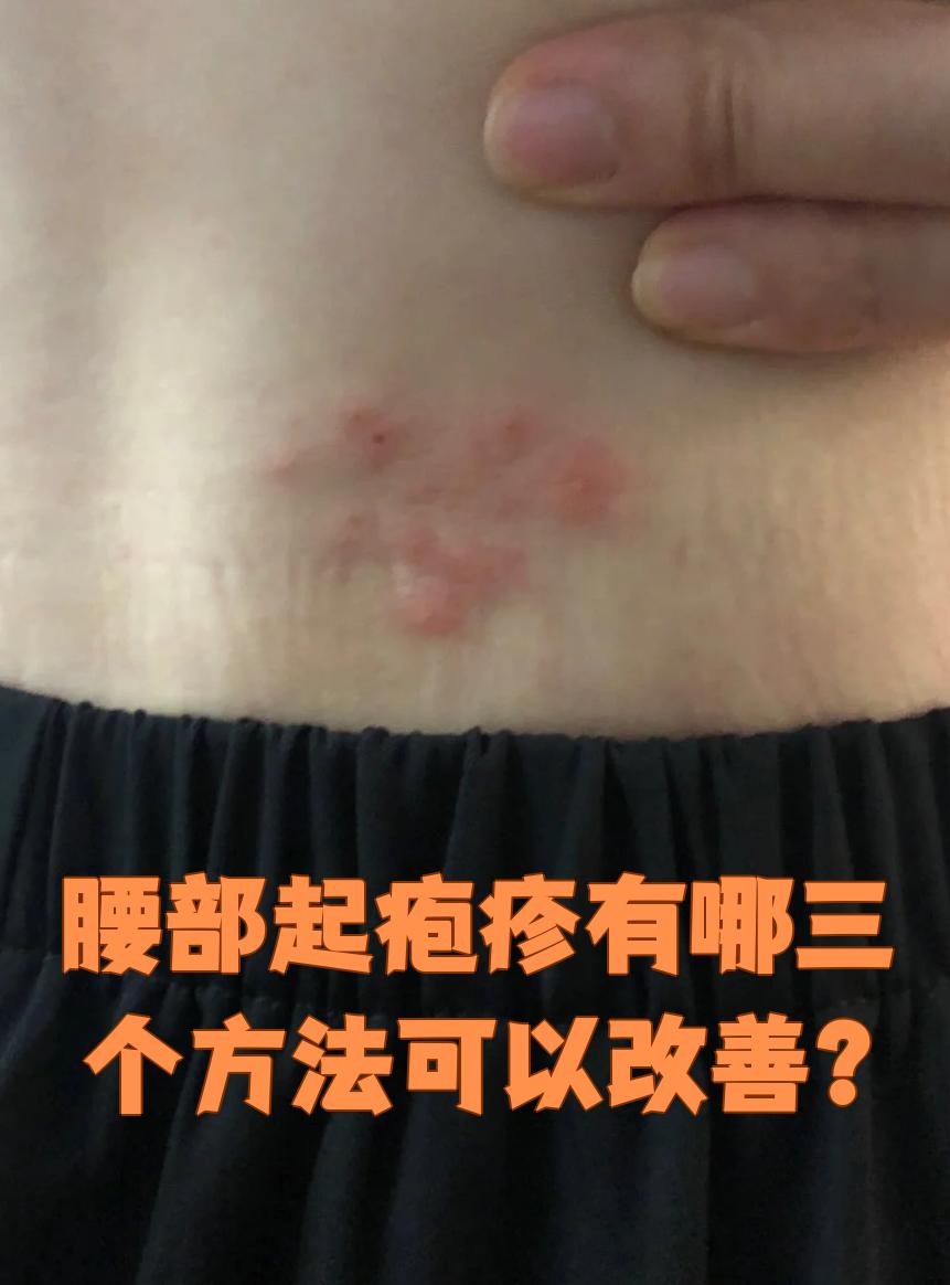 常见的原因是带状疱疹,主要通过以下三种方法改善: