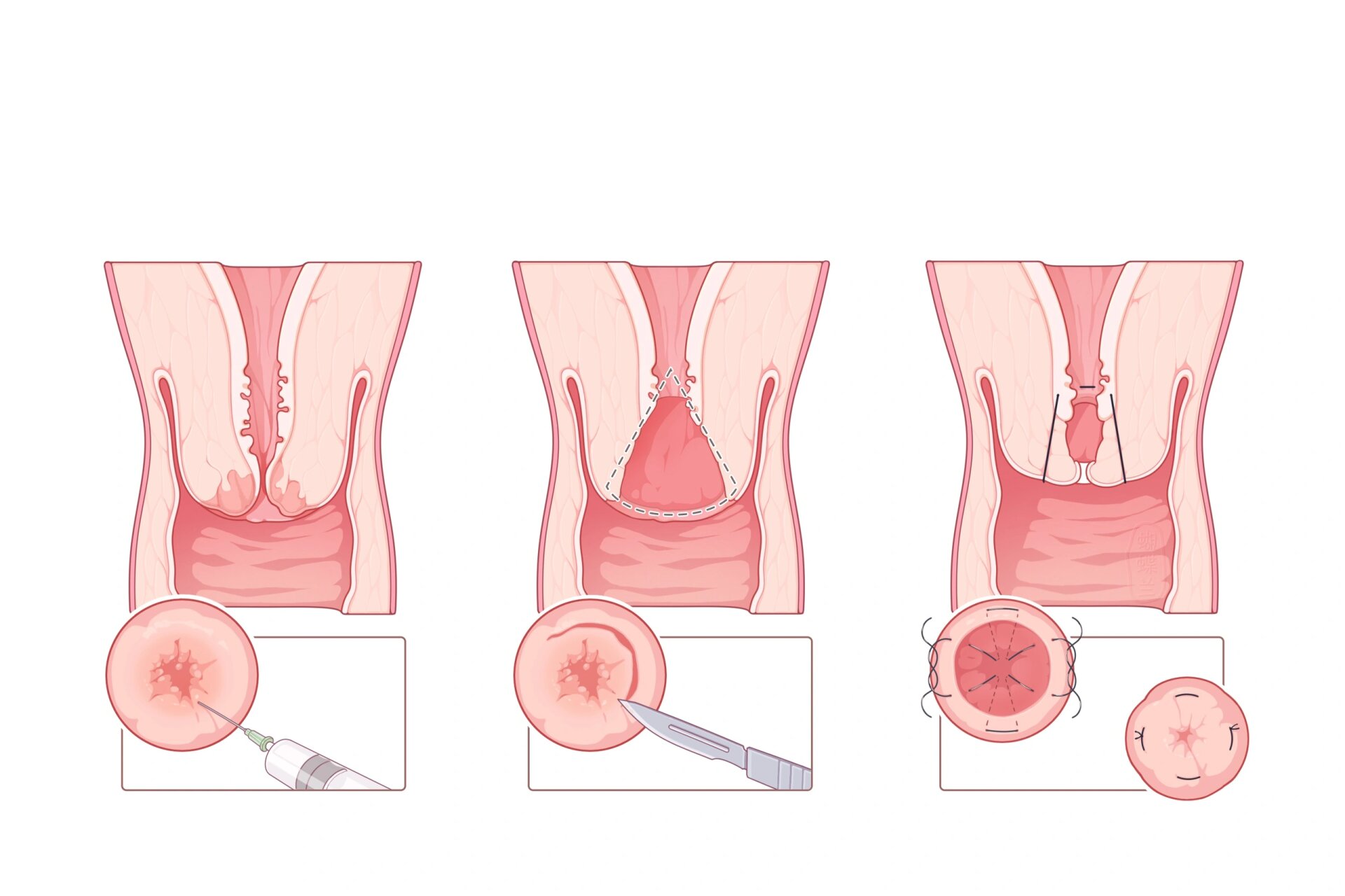 医学插画