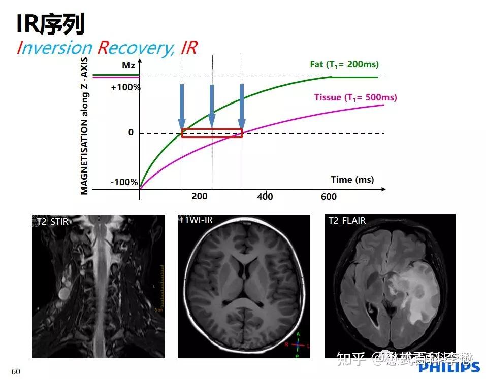 矢状位T2WI图片