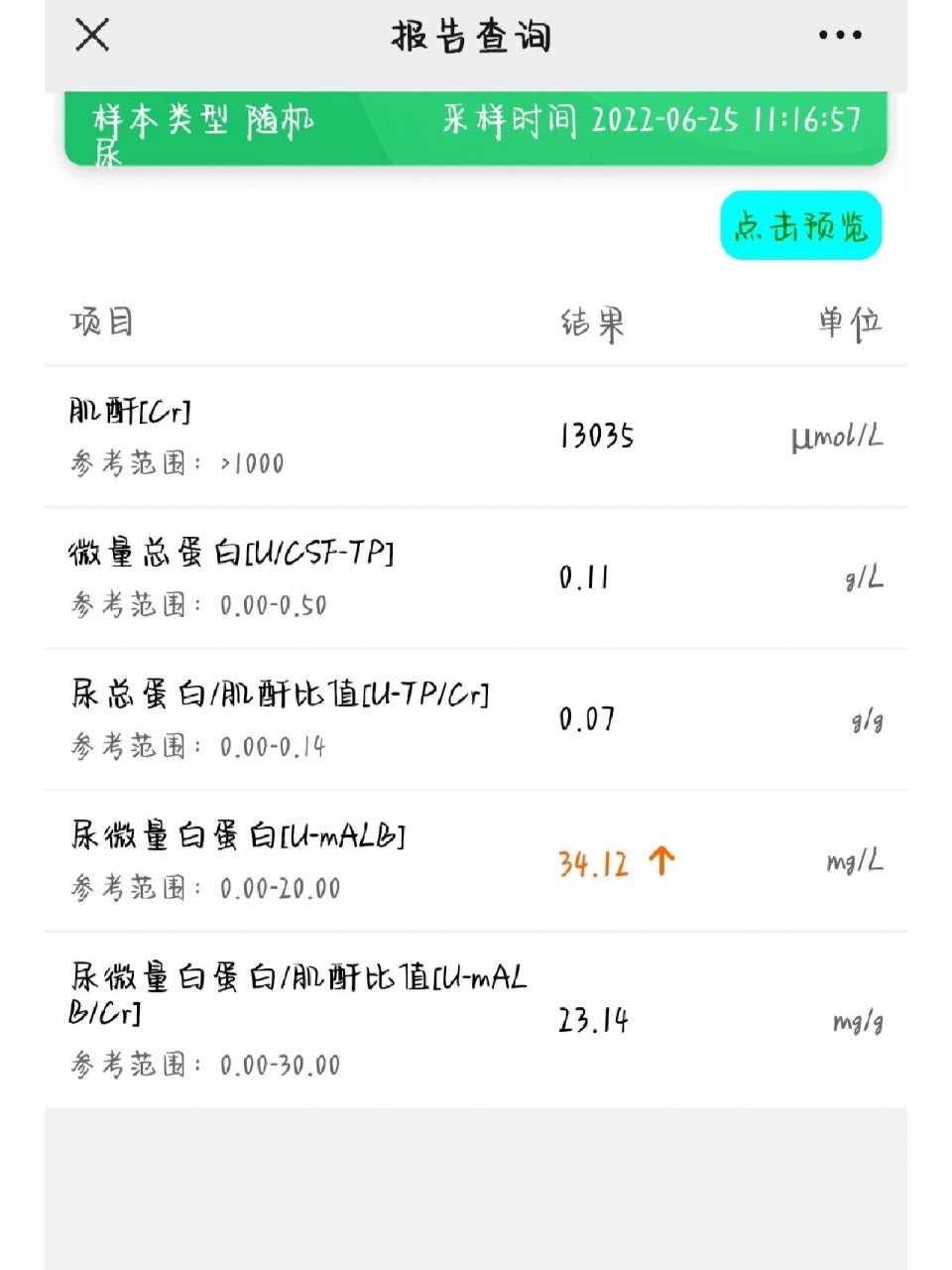尿微量白蛋白高?咋搞 尿微量白蛋白高,这是很偏高很少略高?