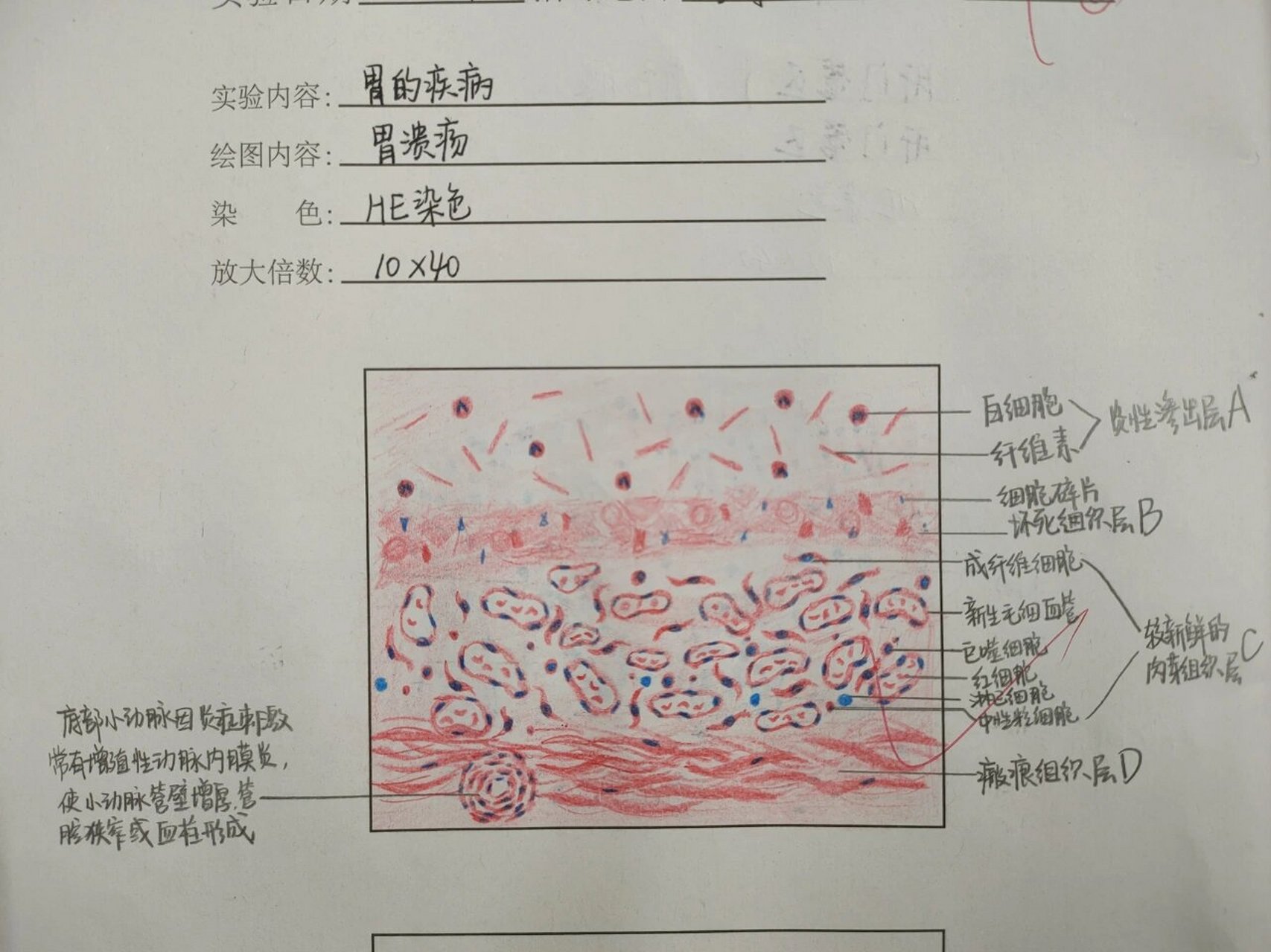 医学病理红蓝铅笔绘图 消化系统 1.消化腺-肝门管区 2.