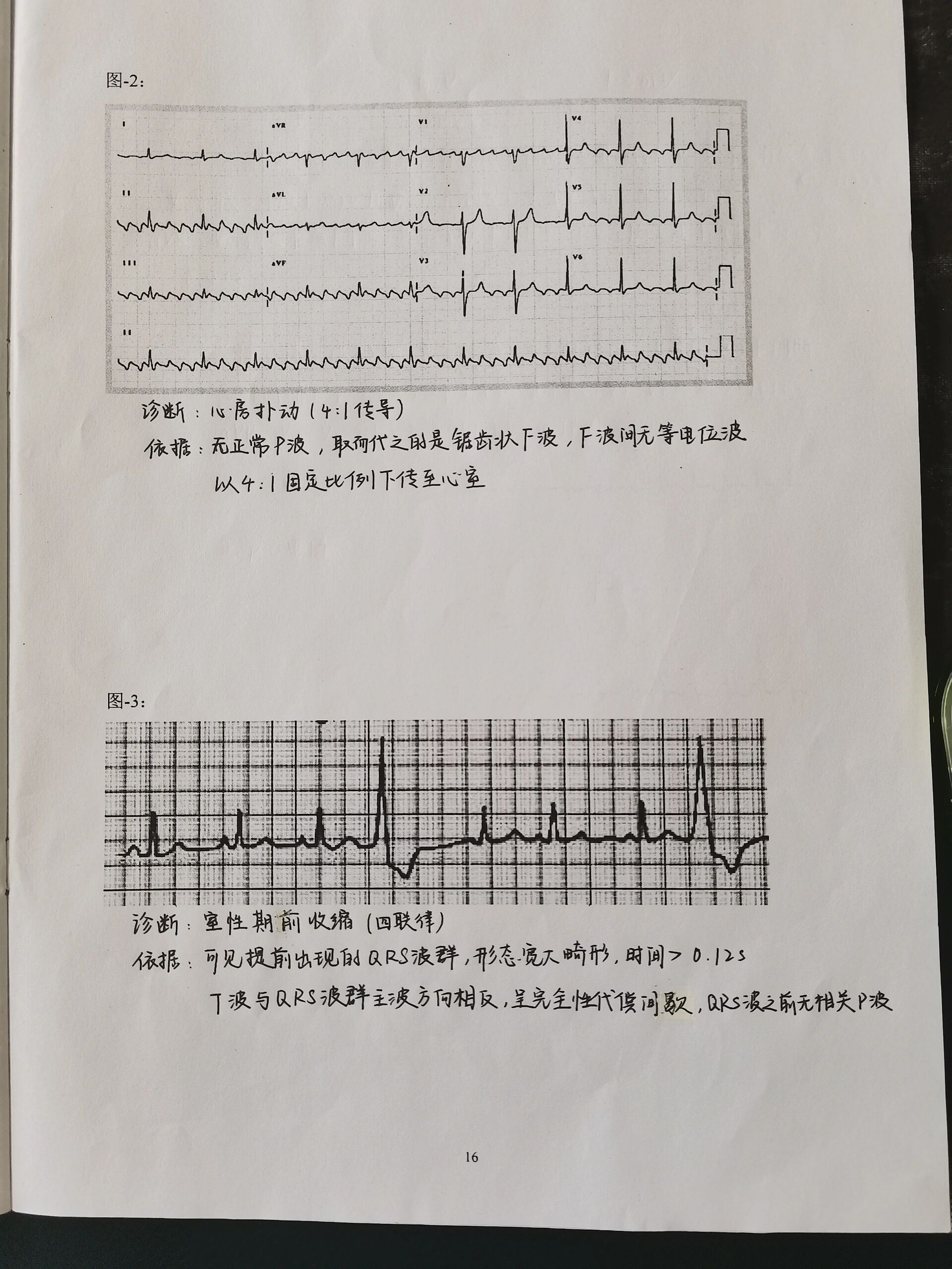 心电图实验报告图片