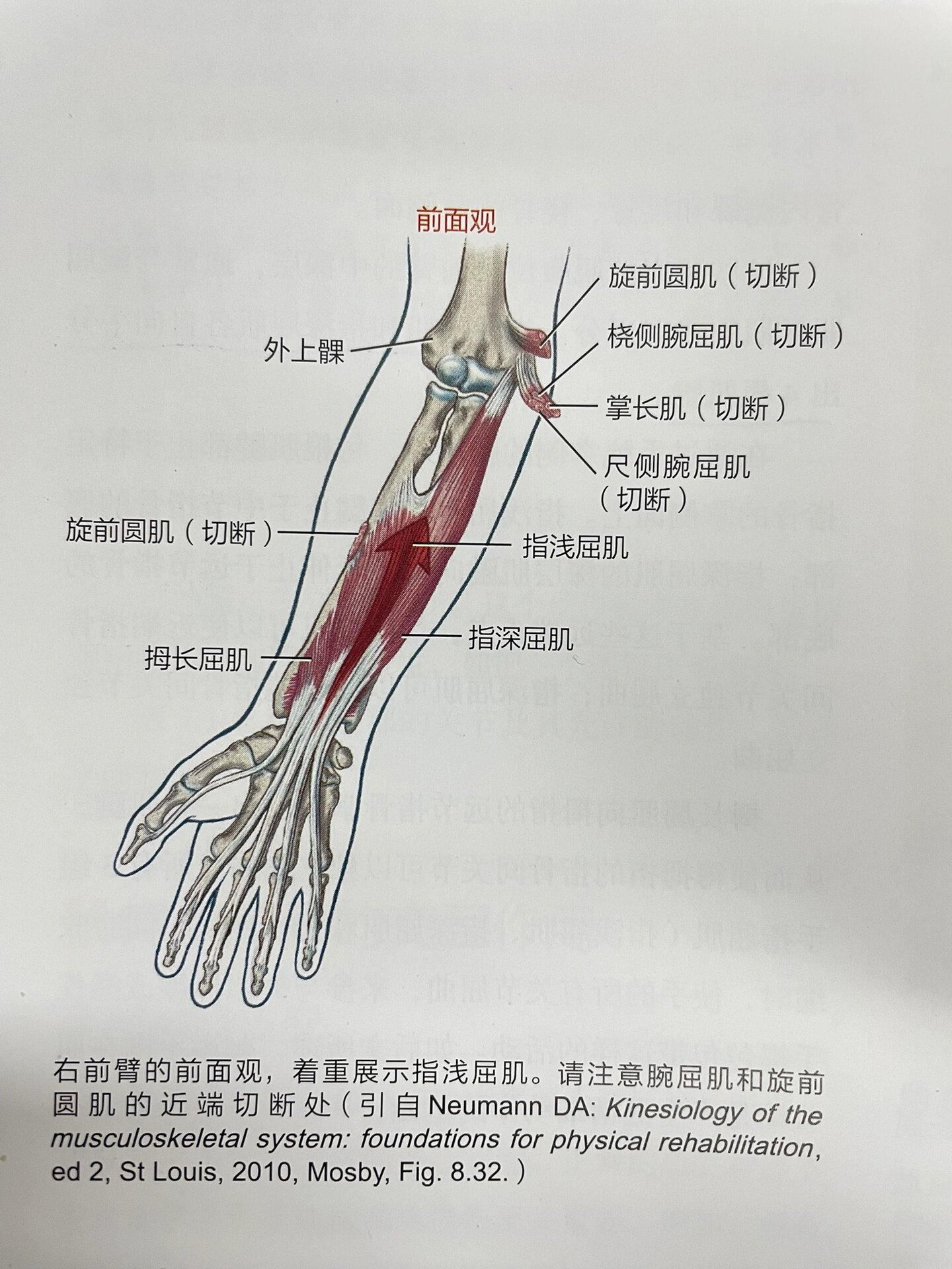 拇长屈肌腱图片