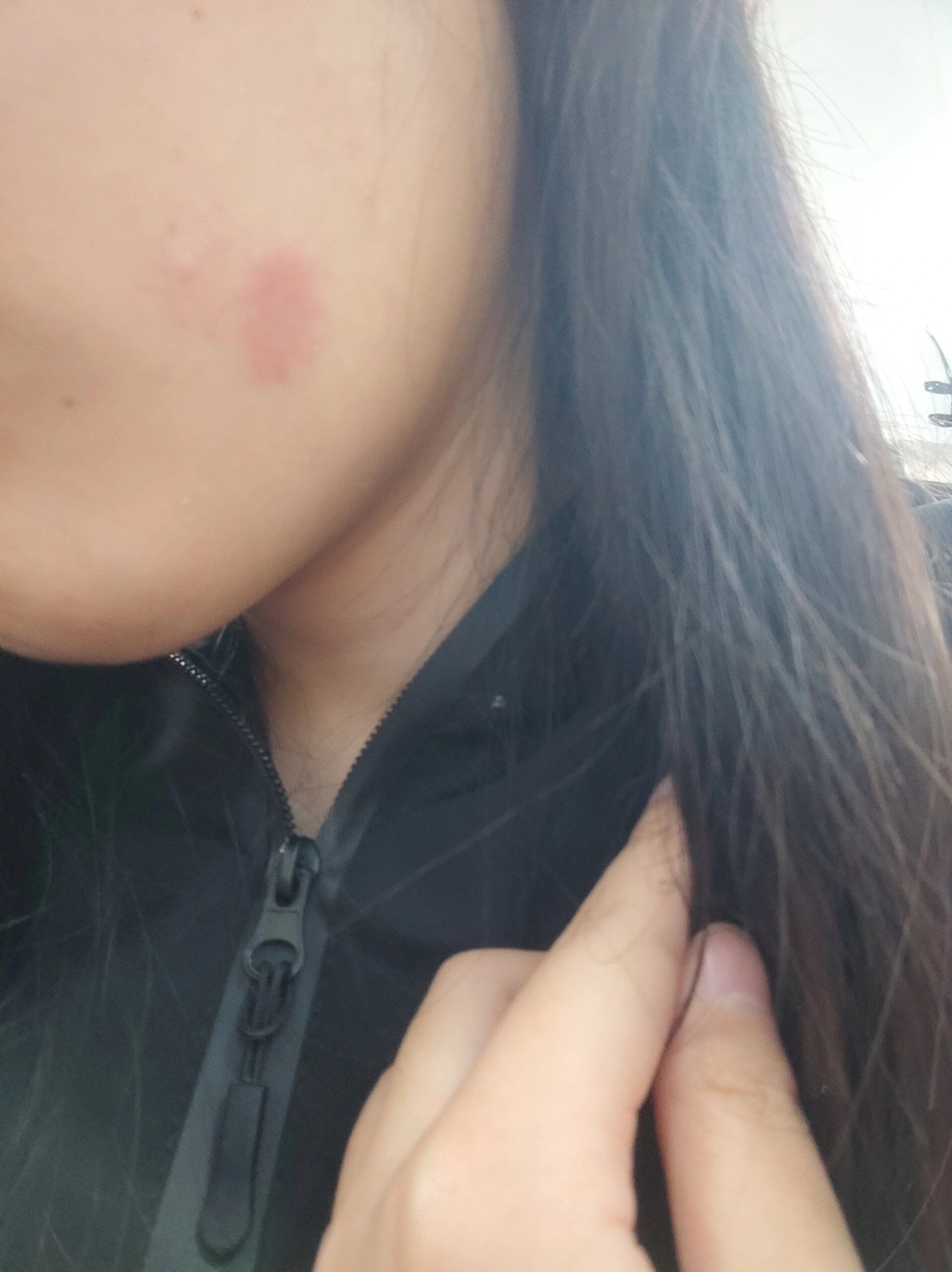 一觉睡醒脸上有个红块