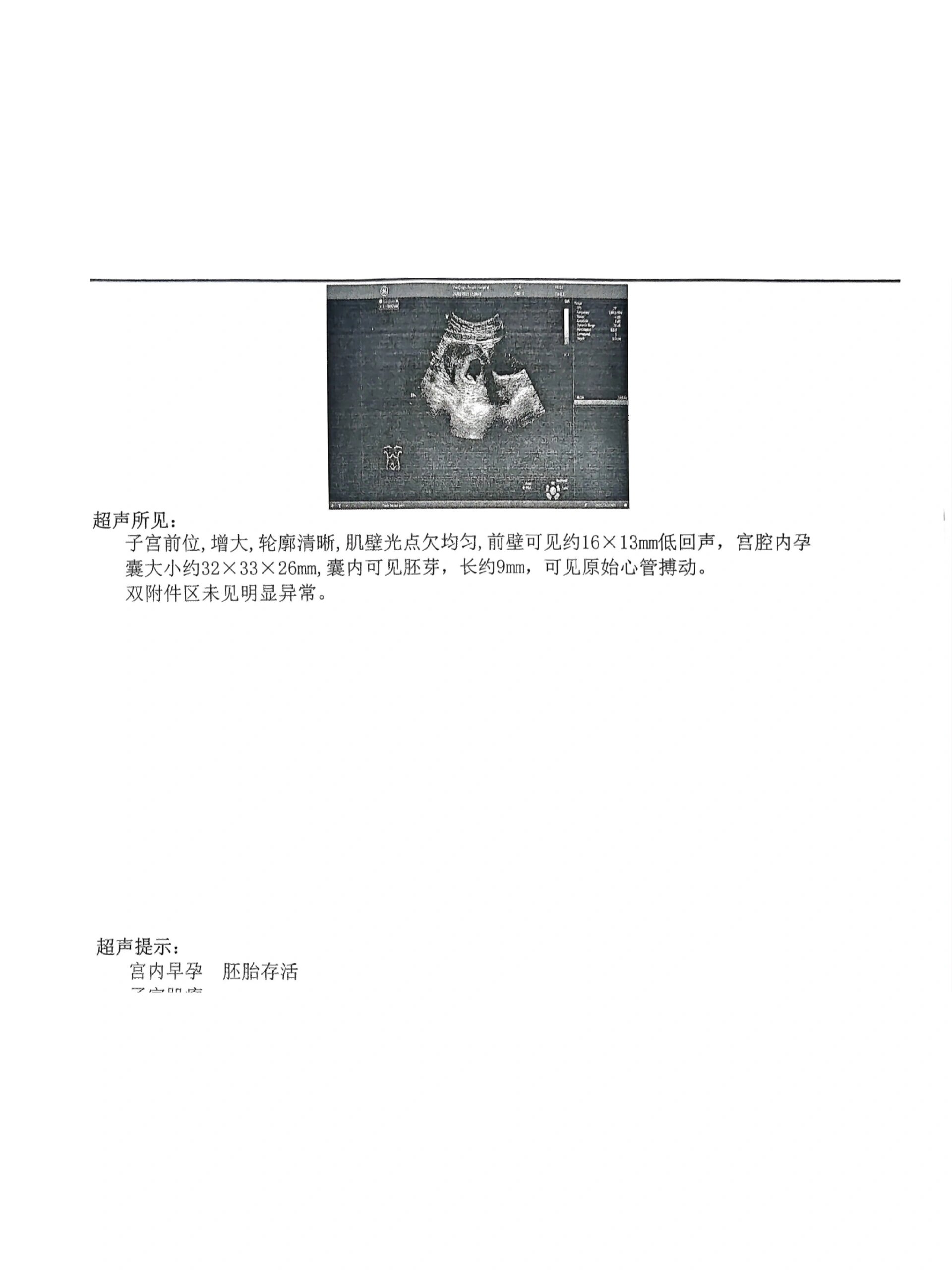 七周 b超确认 因为没做过阴超有点恐惧,等到7周做腹部b超~ 早上喝水吃