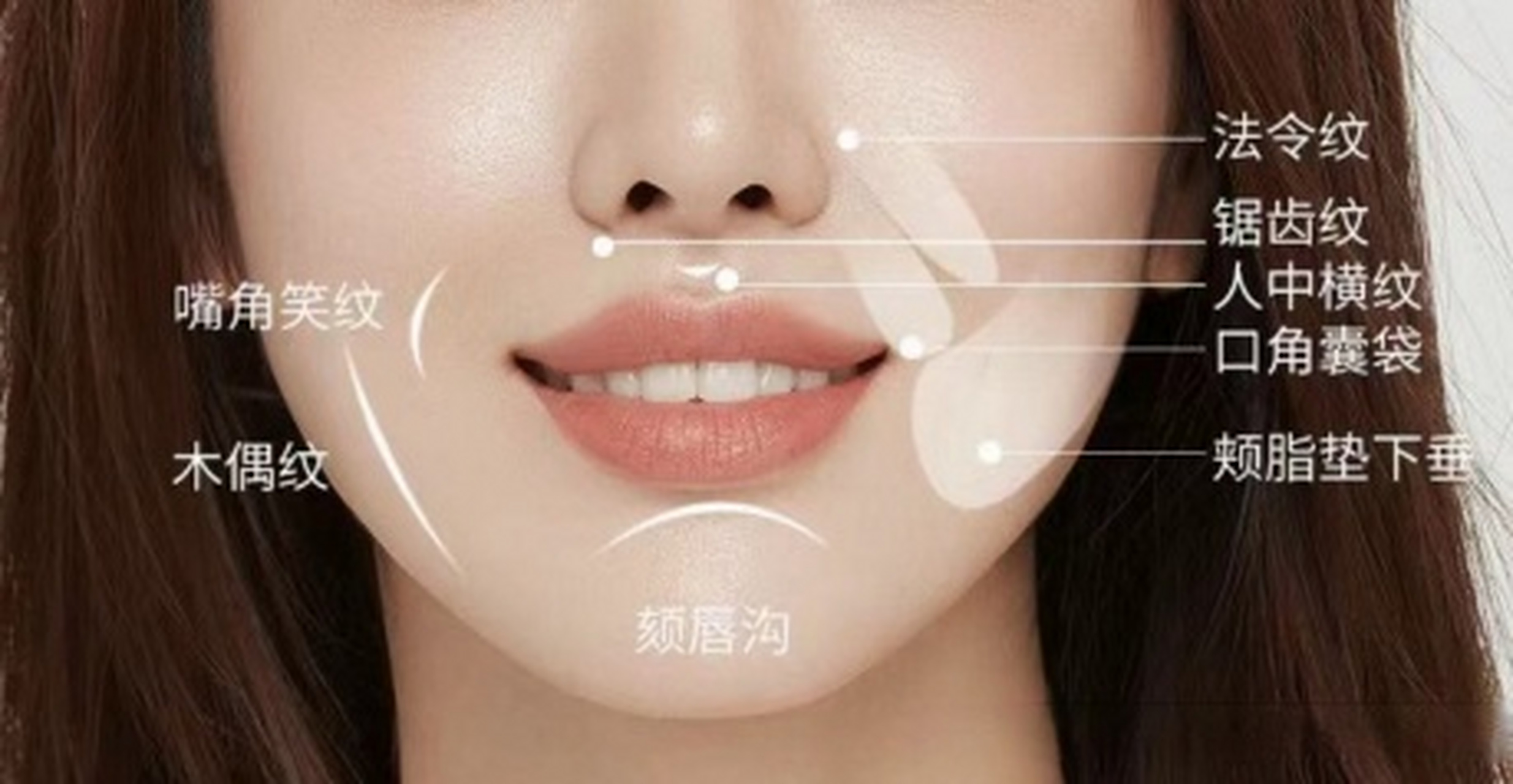 口周年轻化——被忽略的面部抗衰死角  生活中常说:"爱笑的女孩运气都