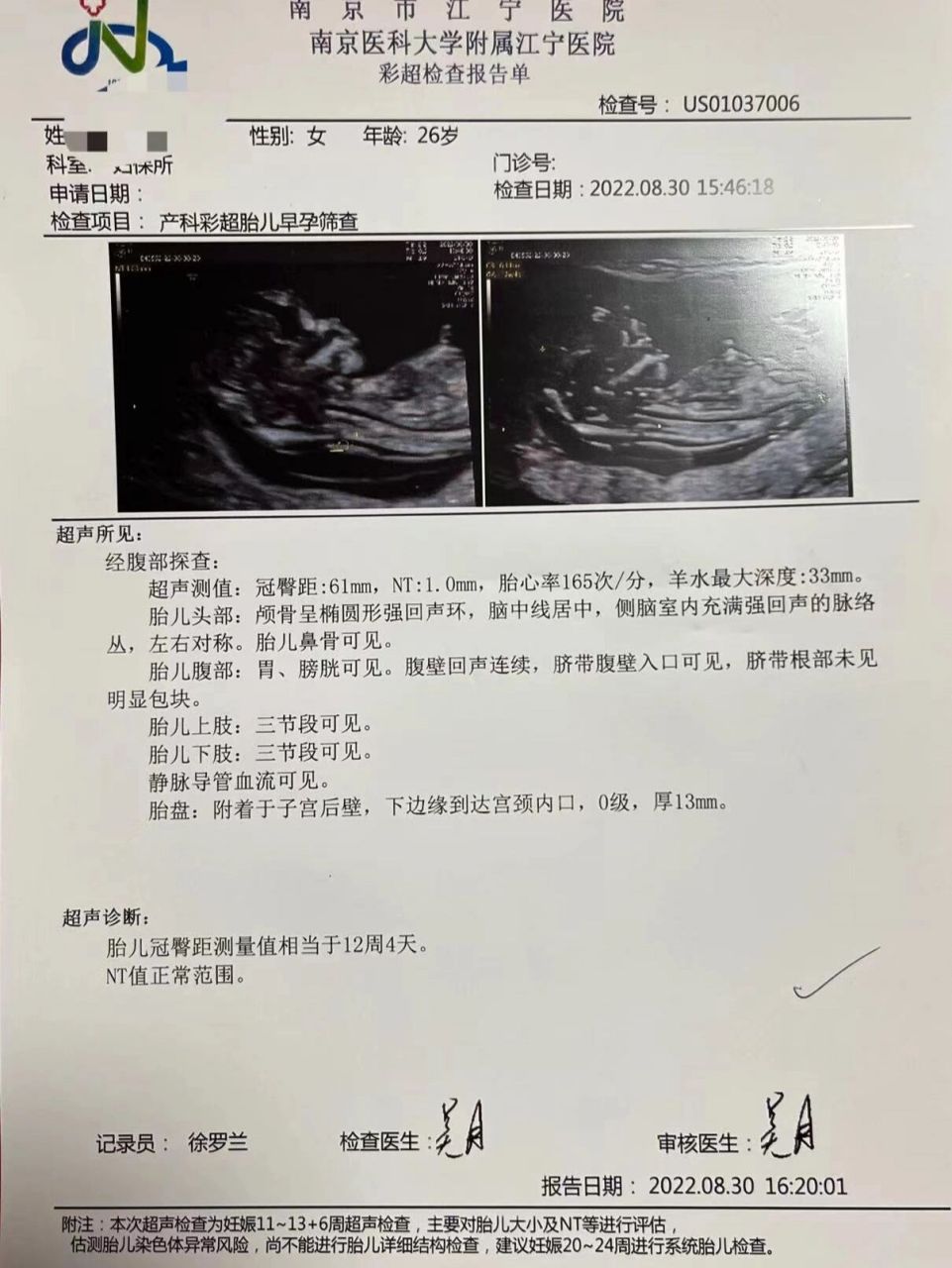 nt顺利通过,南京江宁医院做nt流程 提前一周预约了江宁中医院做nt检查