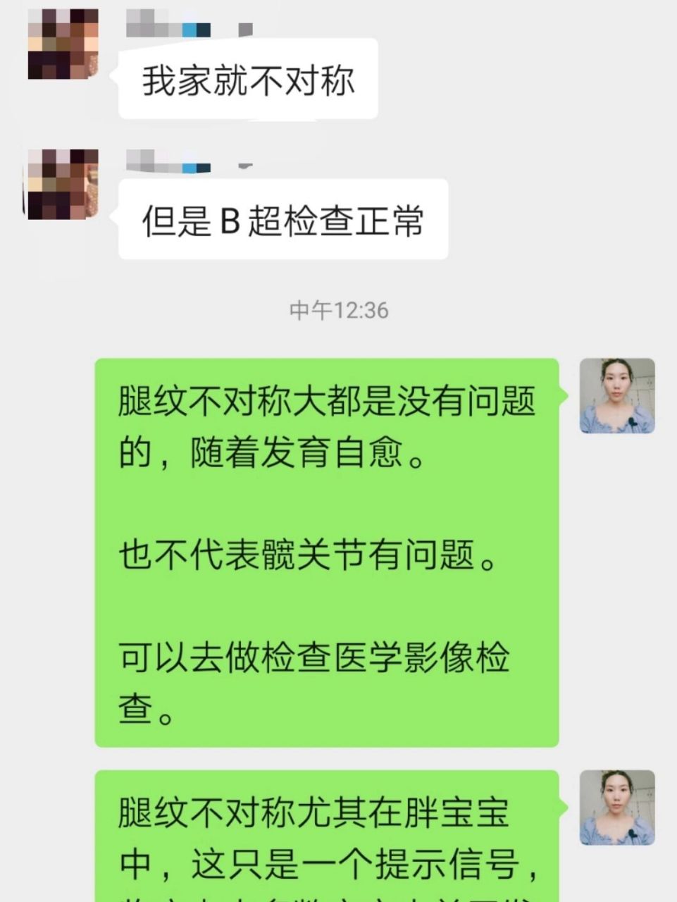 腿纹不对称提示家长关注,不是确诊的依据.