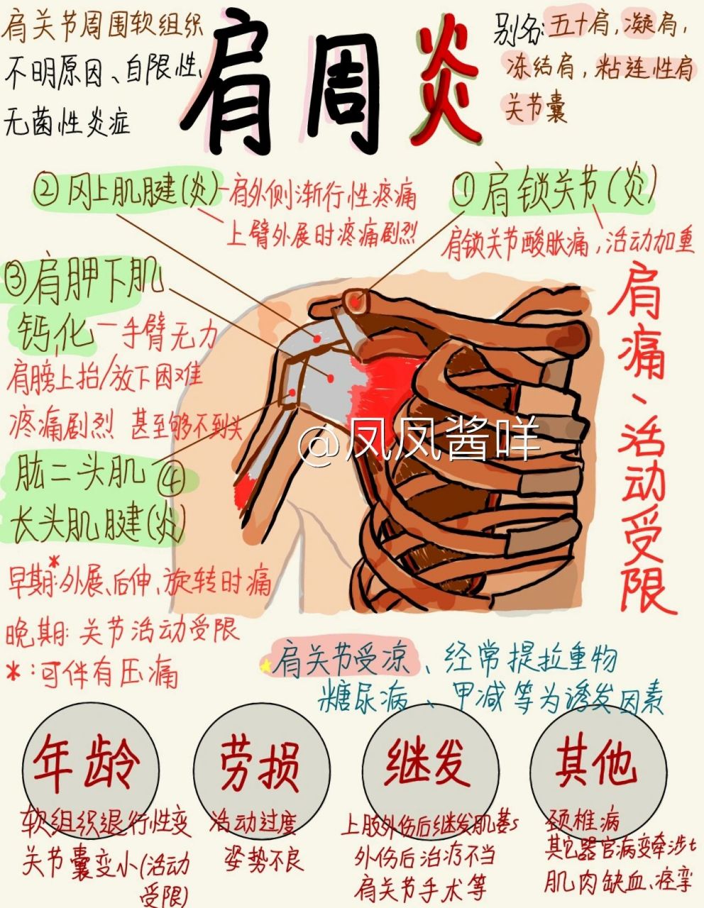 98医学生笔记 | 肩周炎 建议点赞收藏 肩周炎又称"五十肩",因为一般
