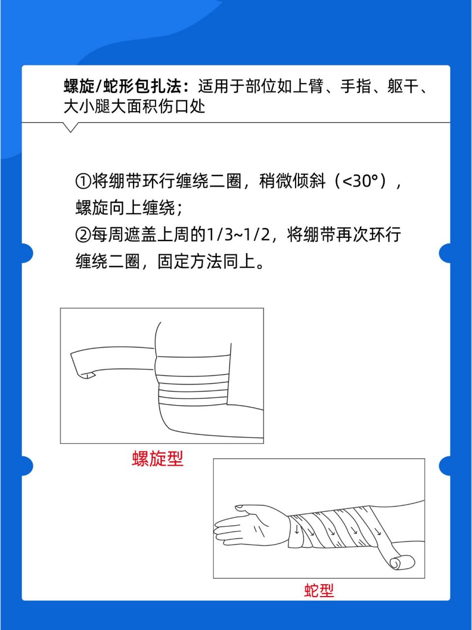 四肢包扎法图片