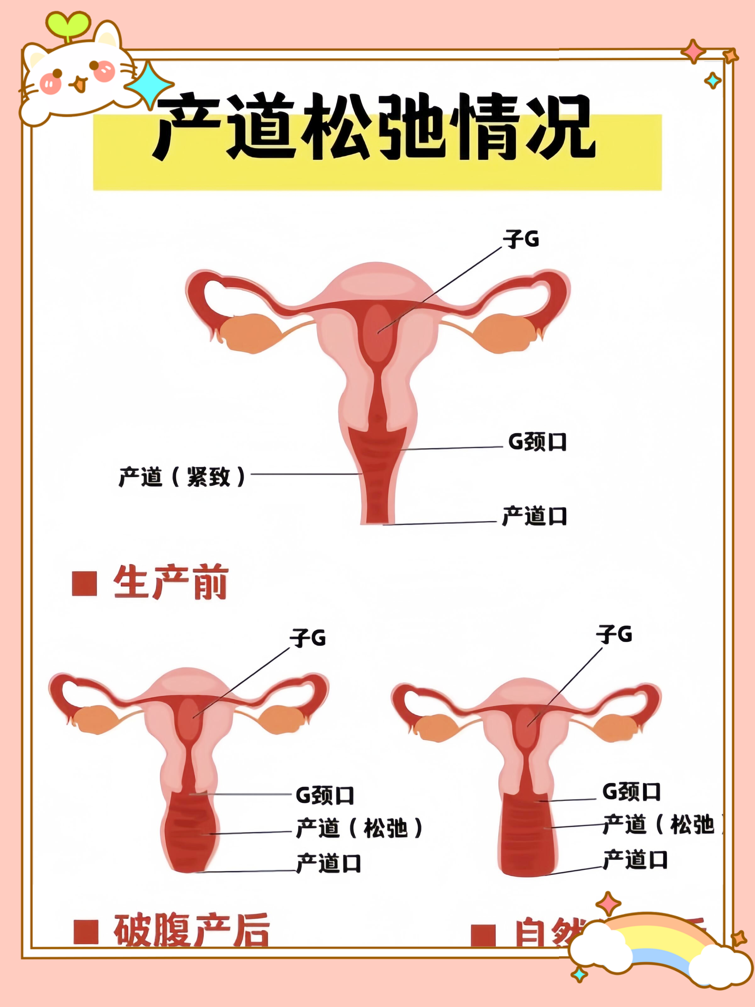 产道 拓宽图片