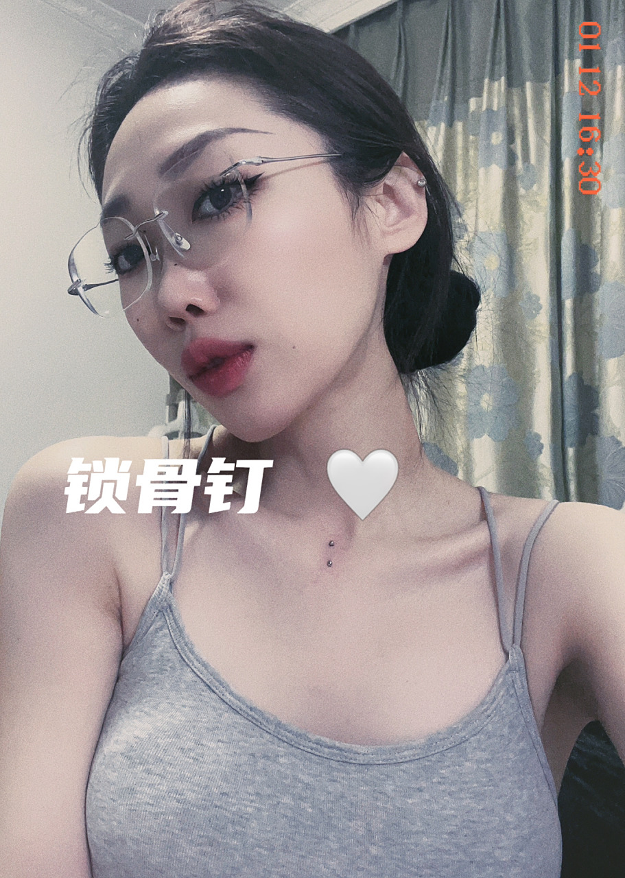 锁骨钉07   07  3月份打了脐钉后,昨天鼓起勇气去安排了锁骨钉 打